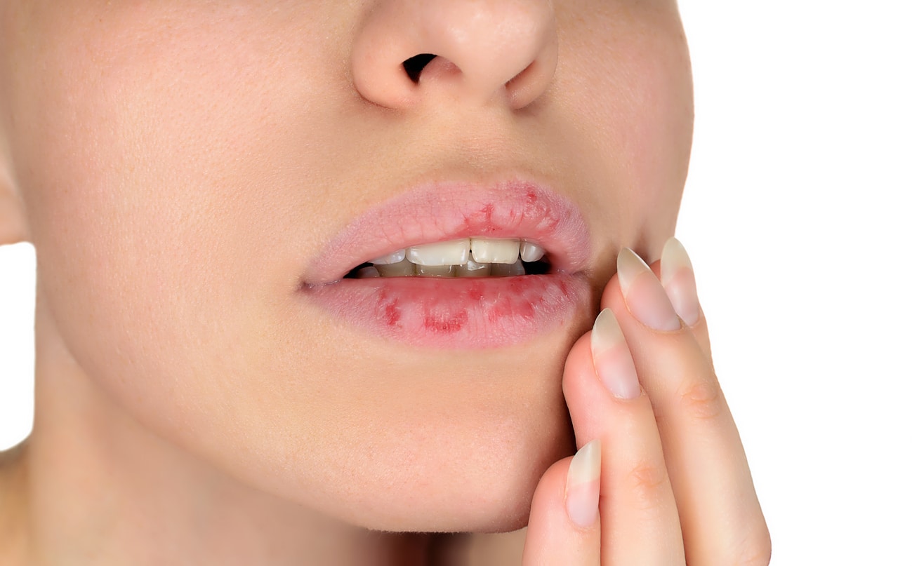 How Do You Know If Your Lip Fillers Have Gone Wrong?