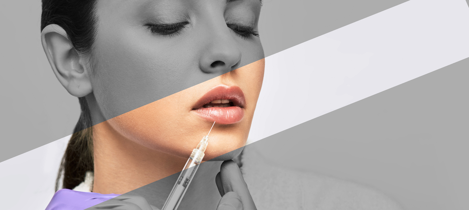 The Top 10 Frequently Asked Questions About Lip Injections 