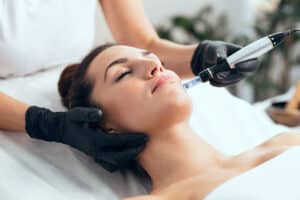 Salmon Sperm PDRN applied to woman's face using microneedling skin rejuvenation technique