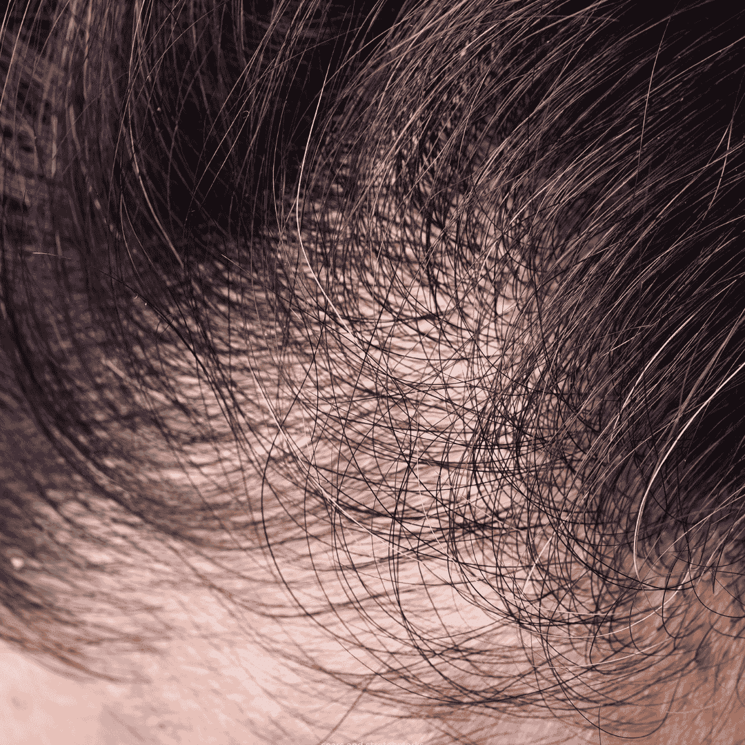 hair and scalp