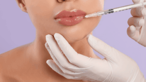 Close-up shot of a practitioner performing a lip filler injection with a syringe on a client.