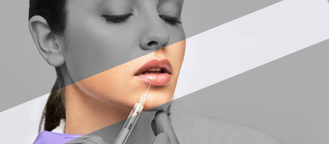 lip injections faq