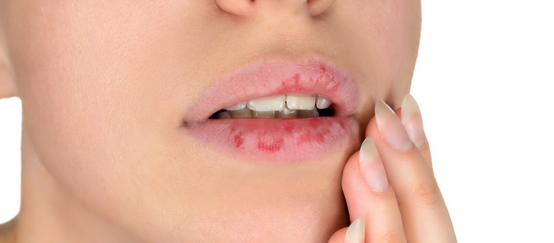 lip-injections-calgary